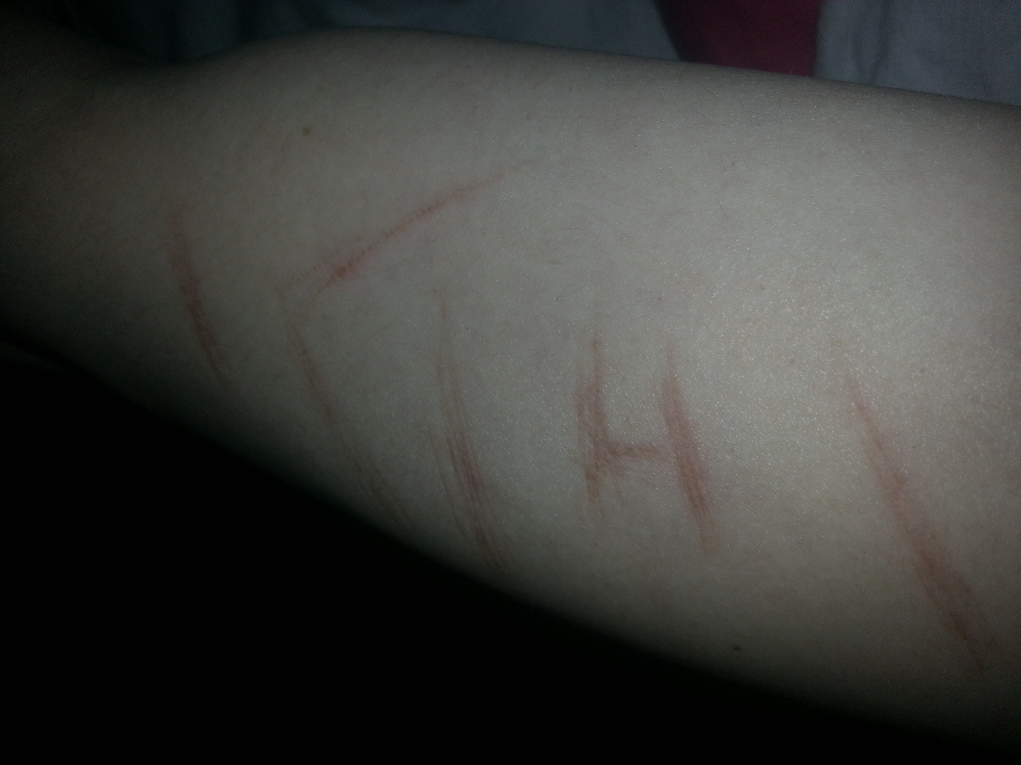 Schnitte Heilen Auch Nach Einer Woche Noch Nicht Haut Heilung Schnittwunde