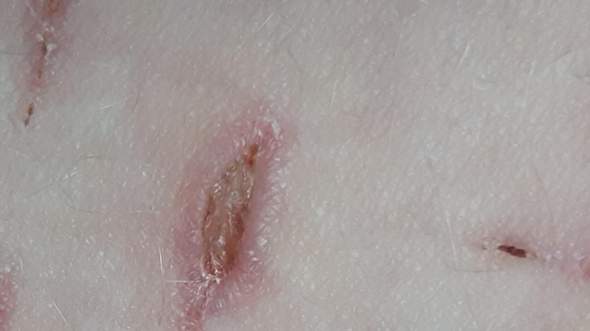 Schnittwunden entzündet? (Schmerzen, Haut, Entzündung)