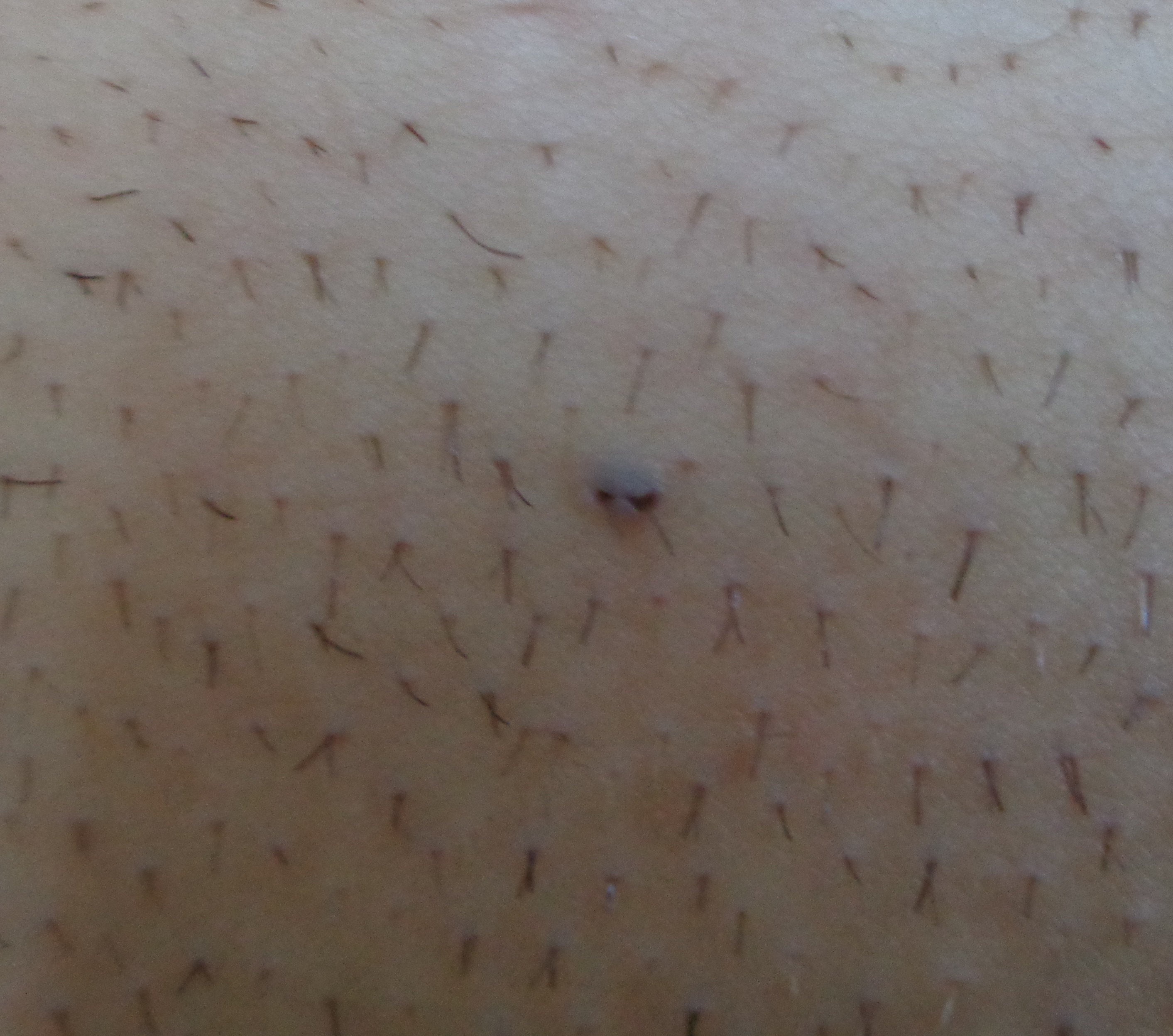 schwarzer punkt im intim bereich