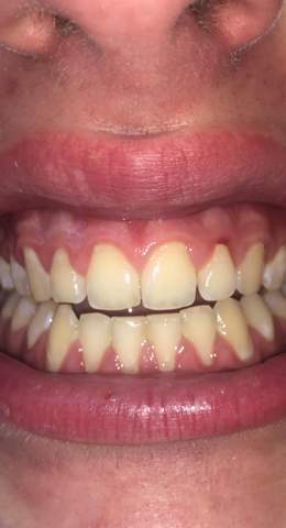 Sehen meine Zähne und mein Zahnfleisch okay aus?