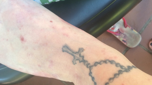 Fuß - (Haut, Ausschlag, Dermatologie)