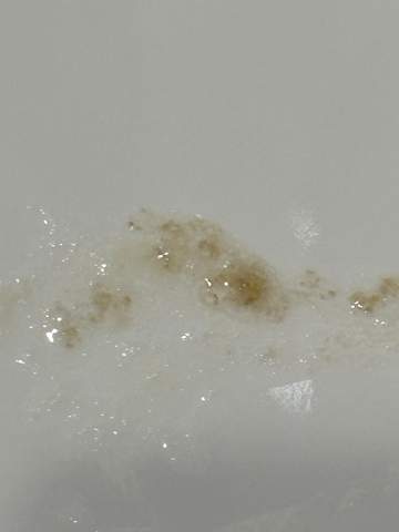 Seit monaten schleim spucken ohne Husten? (Krankheit, Hilfe)