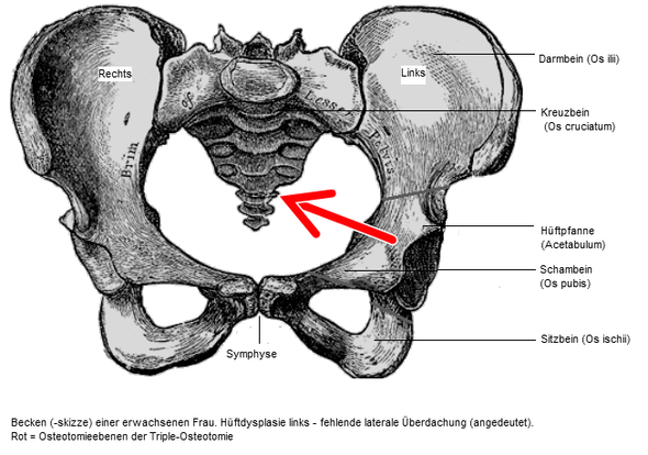 Seit Monaten Schmerzen Links Am Steissbein Bzw Kreuzbeinspitze Was Kann Das Sein Was Befindet Sich Dort Was Kann Ich Nach D Vielen Untersuchungen Noch Tun Hamorrhoiden Darmspiegelung Seit Monaten Schmerzen Links Am Steissbein Bzw Kreuzbeinspitze Was Kann Das Sein Was Befindet Sich Dort Was Kann Ich Nach D Vielen Untersuchungen Noch Tun Hamorrhoiden Darmspiegelung
