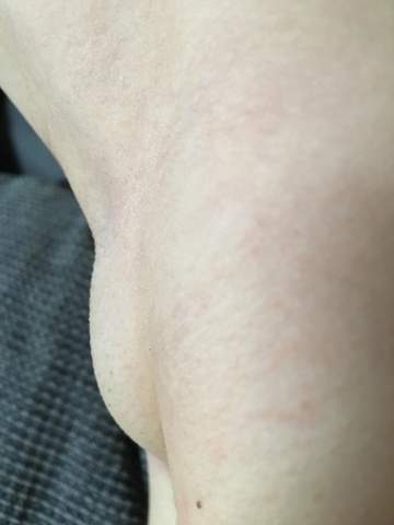 Sind Das Geschwollene Lymphknoten Schmerzen Entzundung Schwellung Sind Das Geschwollene Lymphknoten Schmerzen Entzundung Schwellung