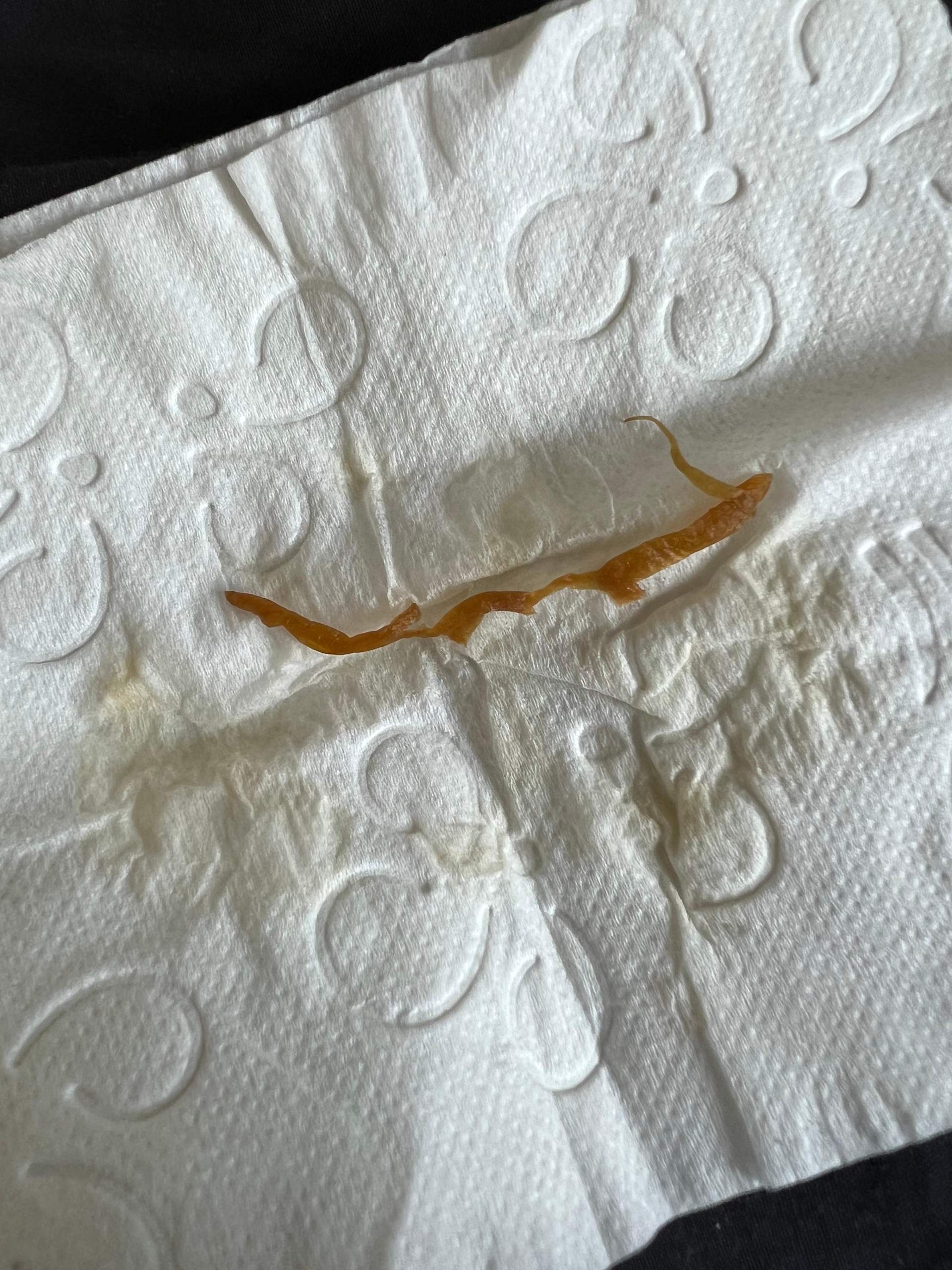 Sind das Würmer im Stuhl? (Darm, Stuhlgang) Sind das Würmer im Stuhl? (Darm, Stuhlgang)