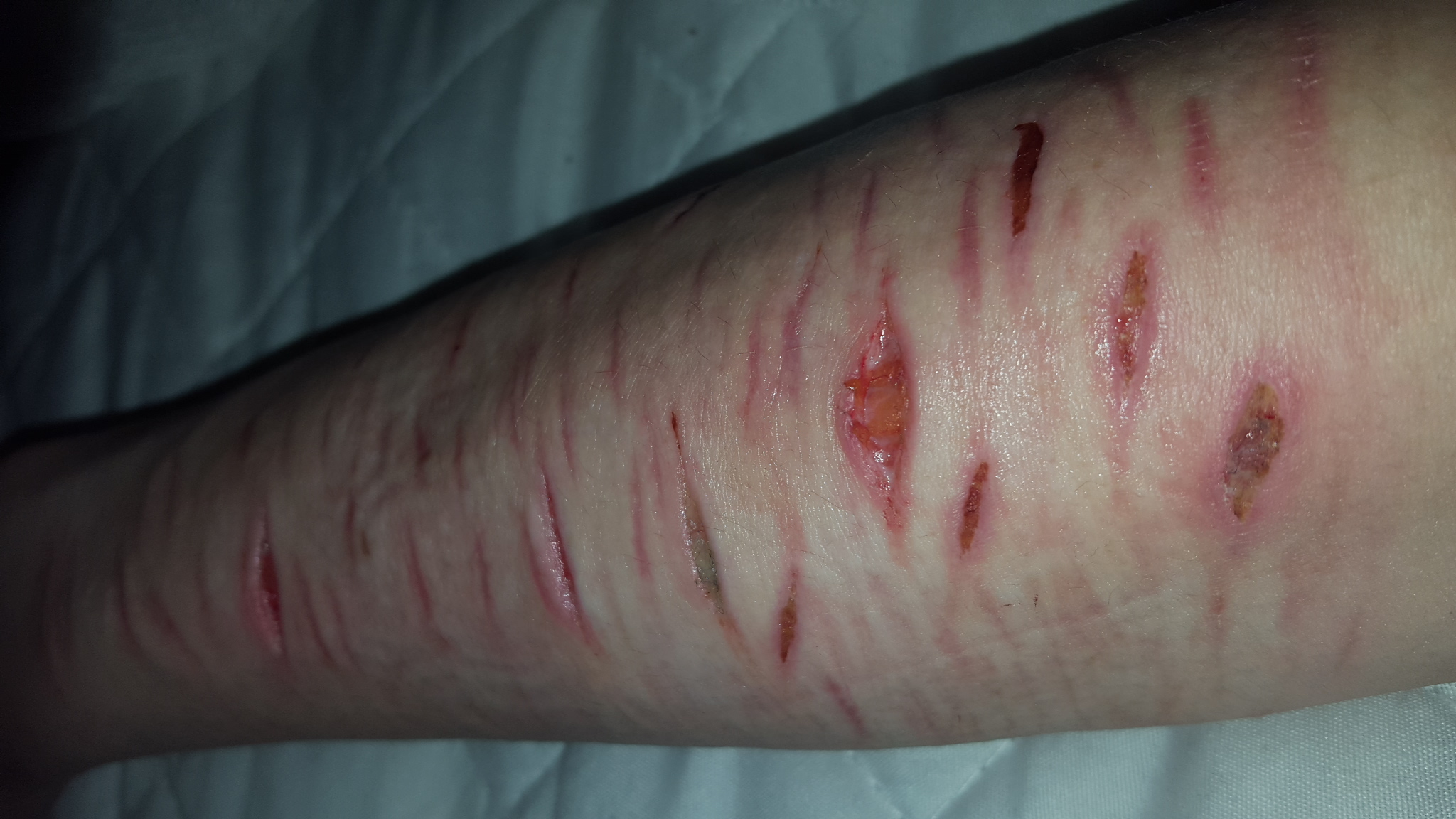 Sind diese Wunden so tief das sie genäht werden müssten oder eher nicht