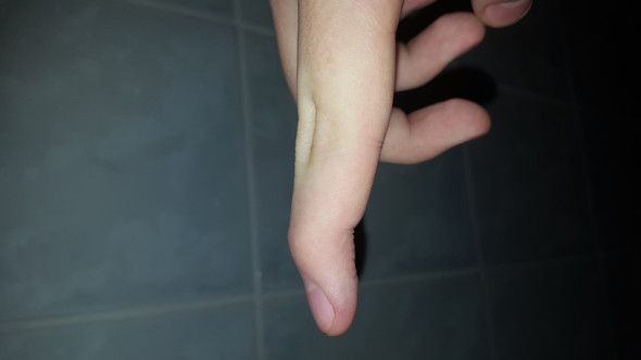 Mein rechter Finger. - (Finger, biegsam)