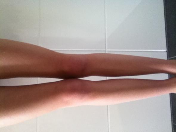 Habe ich zu dünne Beine/Spargelbeine? (Jugendliche) - (Beine, Aussehen)