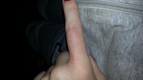 jsjdjd - (Finger, artzt)