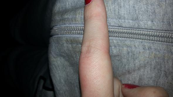 jdkd - (Finger, artzt)