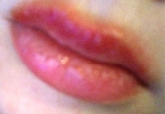 Rand um lippen roter ᐅ Roter