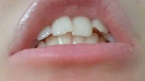 .l - (Zähne, Zahnarzt, Krankenkasse)