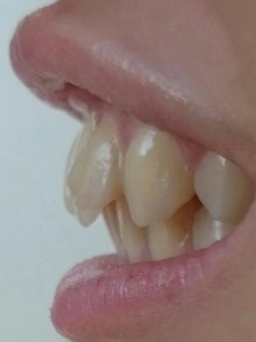 .d - (Zähne, Zahnarzt, Krankenkasse)