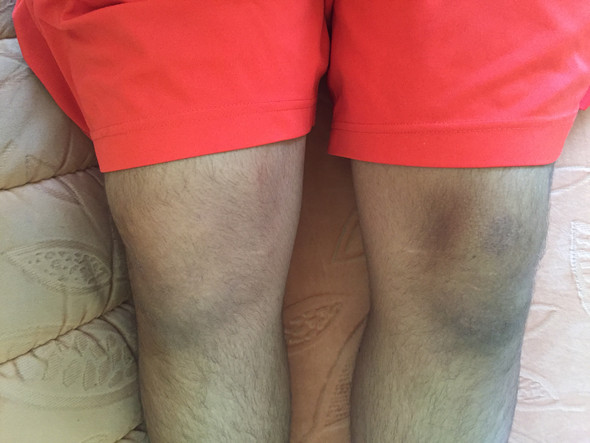 Knie - (Knie, Orthopädie, MRT)