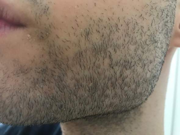 Warum Ist Meine Haut Unter Meinem Bart So Schlimm Habe Ich Eine Hautkrankheit Haare Hautpflege Warum Ist Meine Haut Unter Meinem Bart So Schlimm Habe Ich Eine Hautkrankheit Haare Hautpflege