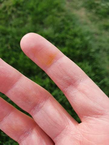 Warum verfärben sich meine Finger gelb?