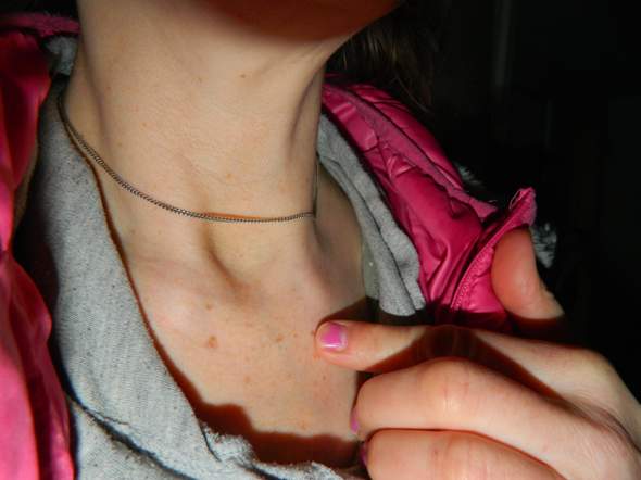 Was Genau Liegt An Dieser Stelle Des Korpers Gesundheit Hals Lymphknoten Was Genau Liegt An Dieser Stelle Des Korpers Gesundheit Hals Lymphknoten