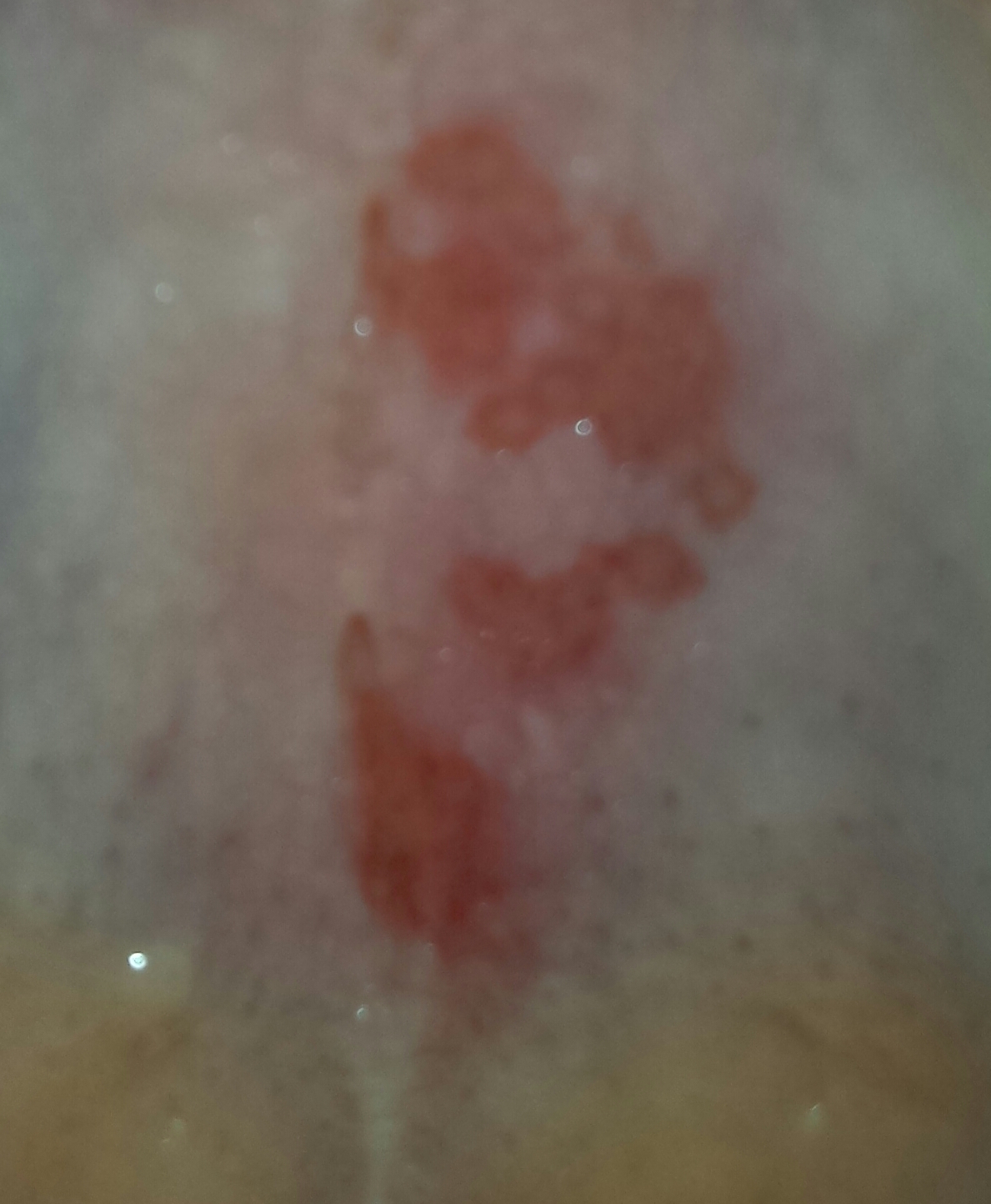 was ist das ? (Gaumen) (Mund, Bläschen) was ist das ? (Gaumen) (Mund, Bläschen)