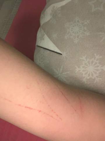- (Angst, Rote striche)