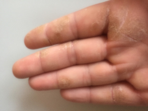 Meine rechte Hand - (Haut, Hand, Hautpflege)