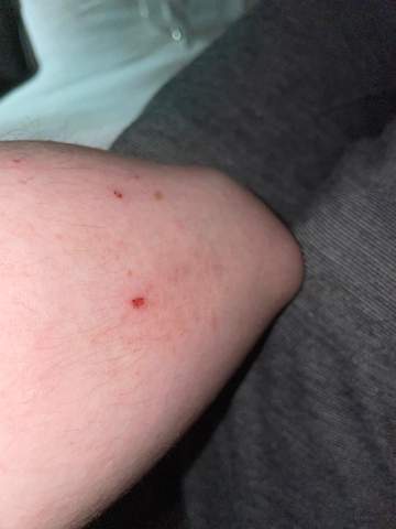 - (Ausschlag, Dermatologie)