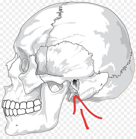 Was Ist Das Fur Ein Knochen Kopf Panik Hws
