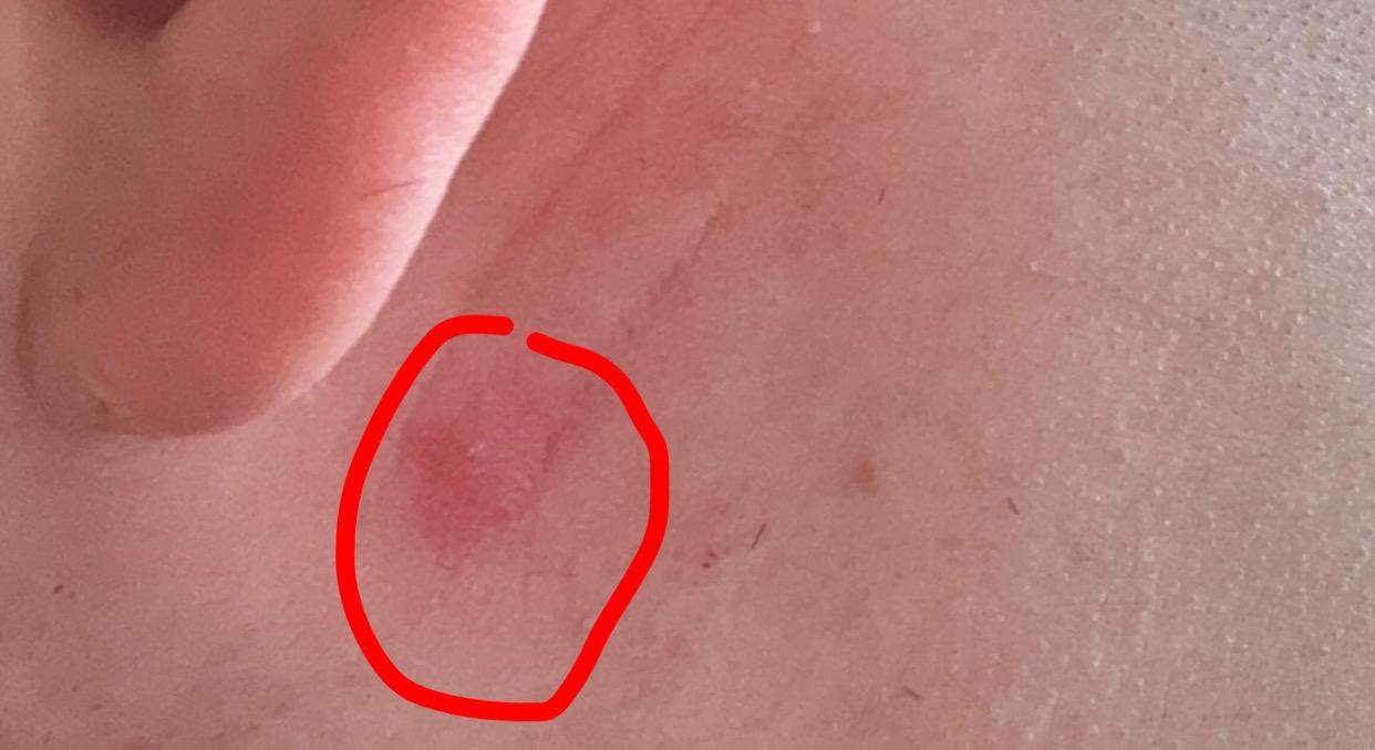 Hinter Genus Was ist das hinter meinem Ohr? (Medizin)