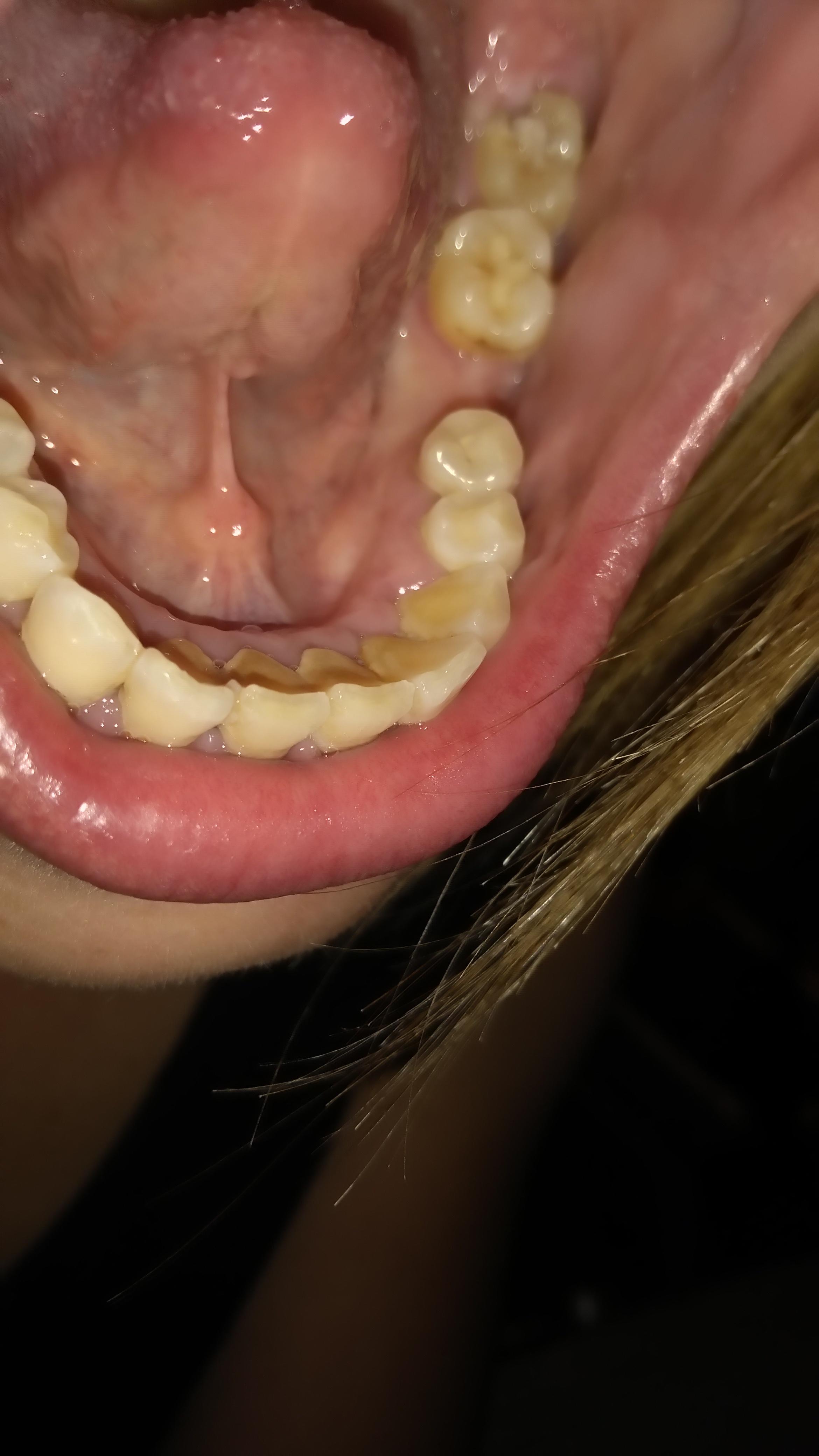 Was ist in meinem Mund und Rachenraum los? (Schmerzen, Rachen