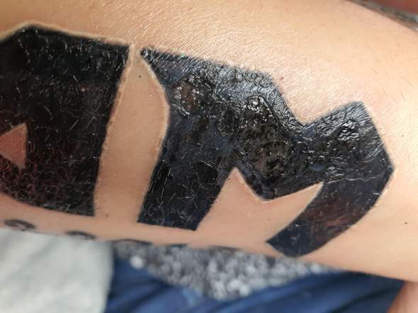 Was ist zu machen ein Teil von meinen Tattoo eidert tut aber nicht weh und ist auch nicht rot?