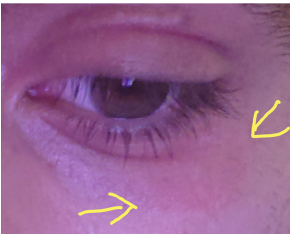 Was Kann Das Sein Und Wie Geht Das Weg Schmerzen Haut Was Kann Das Sein Und Wie Geht Das Weg Schmerzen Haut