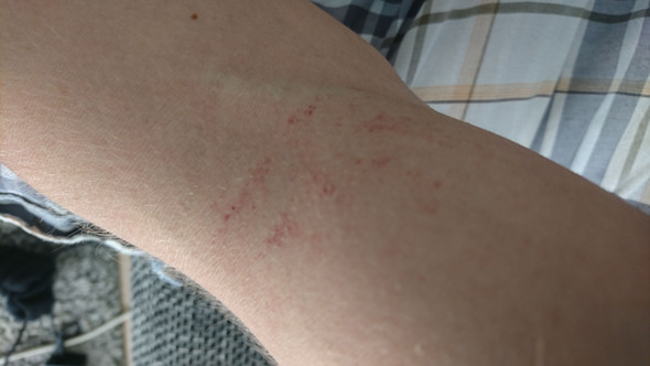 - (Sport, Blut, Muskeln)