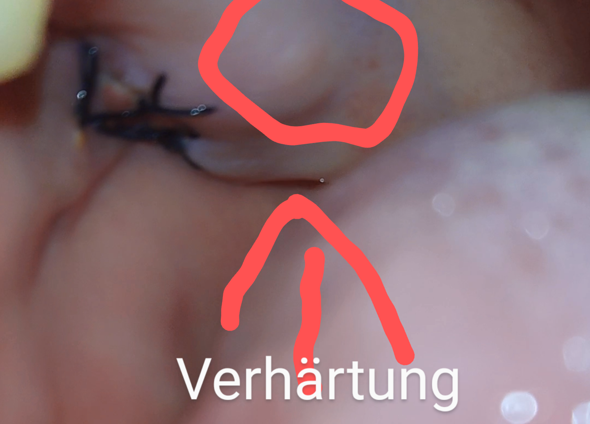 - (Schmerzen, Zahnarzt, kiefer)