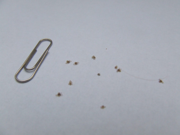 Ausschlag Am Fuss Mit Kleinen Roten Punkten Bilder