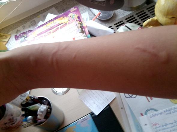 - (Haut, empfindliche Haut)