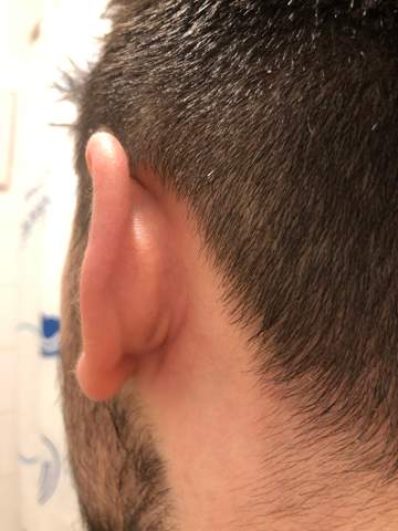 Weiß jemand was das hinter meinem Ohr ist?