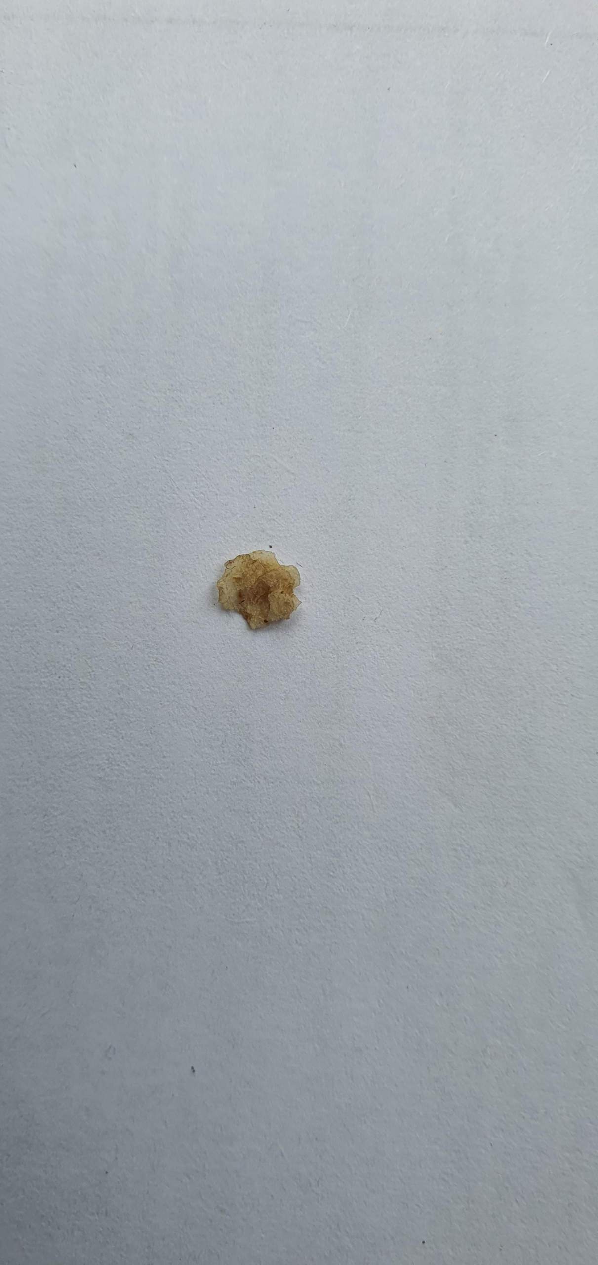 Weiße harte stelle Zahnfleisch? (Zähne)