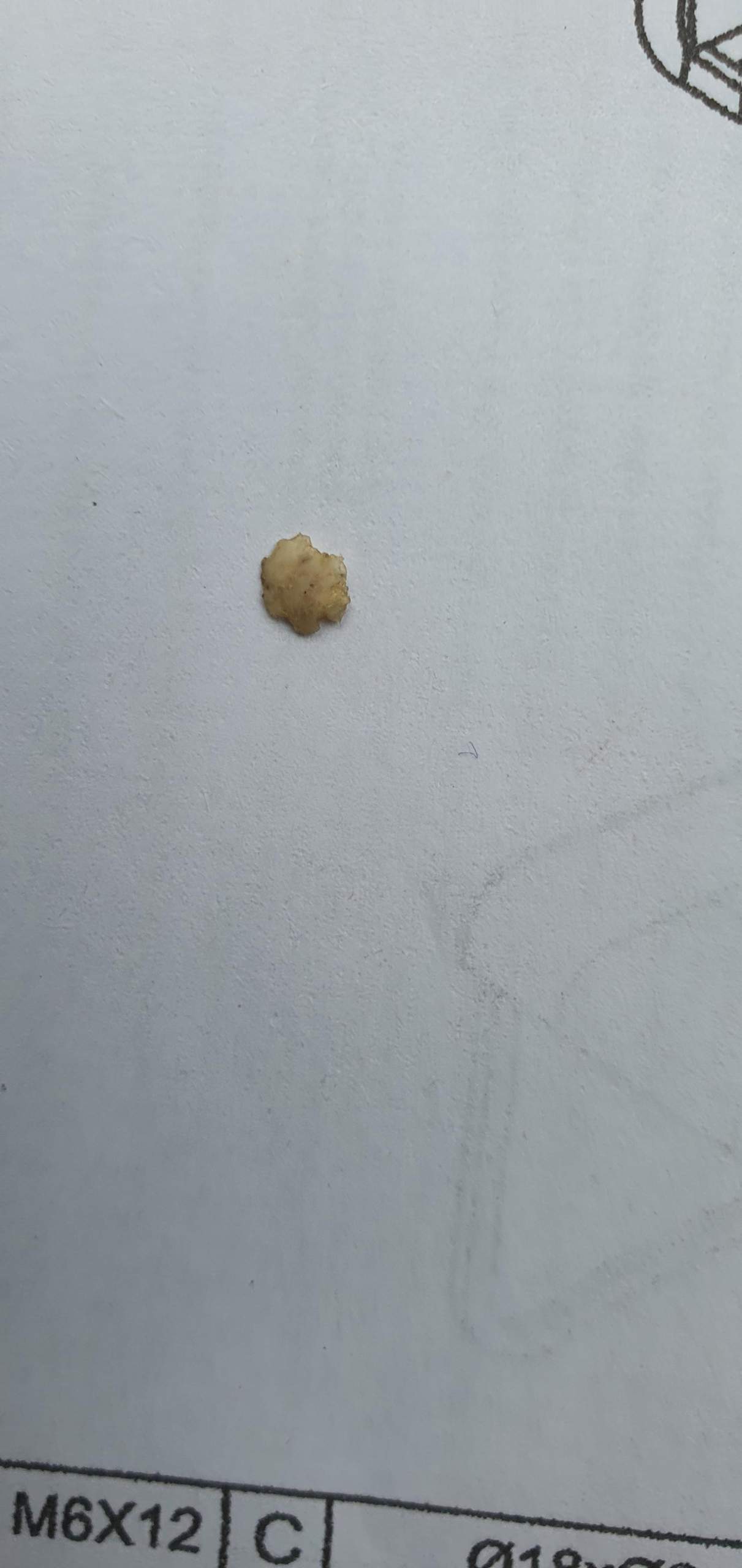 Weiße harte stelle Zahnfleisch? (Zähne)