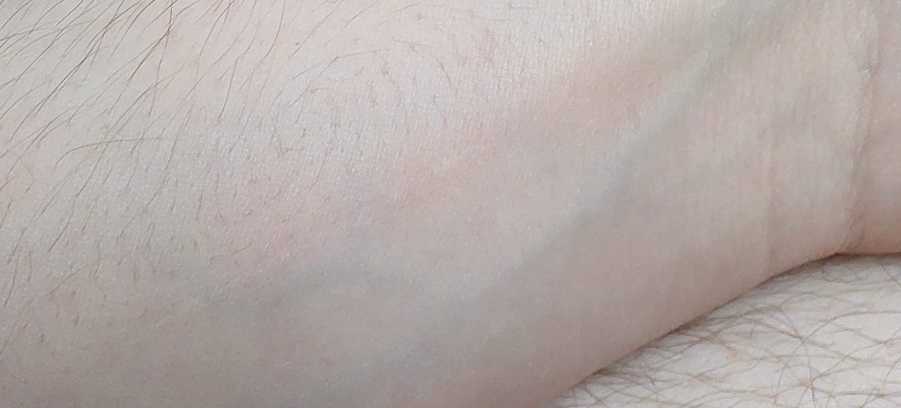 Weißer Strich auf dem linken Unterarm?