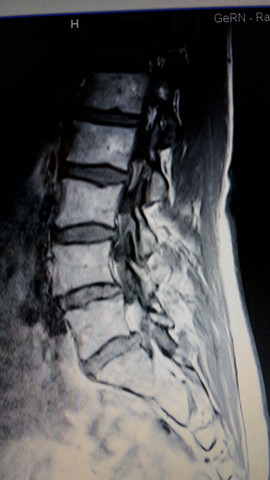 Herman nachrichtensprecherin moderatorin sitzt unternehmerin beinen übereinander sessel geschlagenen sabine bildbanksfoton stockfoto Wer kann mir diese MRT Aufnahmen der LWS auswerten ? (Wirbelsäule, Befund)