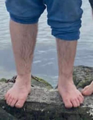Wieso Sind Meine Waden So Untertschiedlich Dick Gesundheit Arzt Korper Wieso Sind Meine Waden So Untertschiedlich Dick Gesundheit Arzt Korper