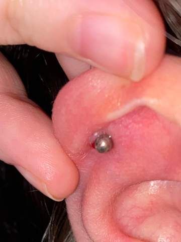 - (Entzündung, Piercing, Wildfleisch)