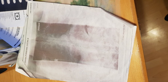 - (Psyche, Rückenschmerzen, Orthopädie)