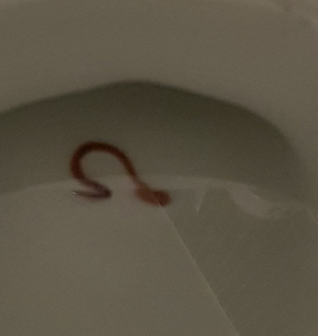 Wurm Im Wc Hilfe Wurmer Wurm Im Wc Hilfe Wurmer