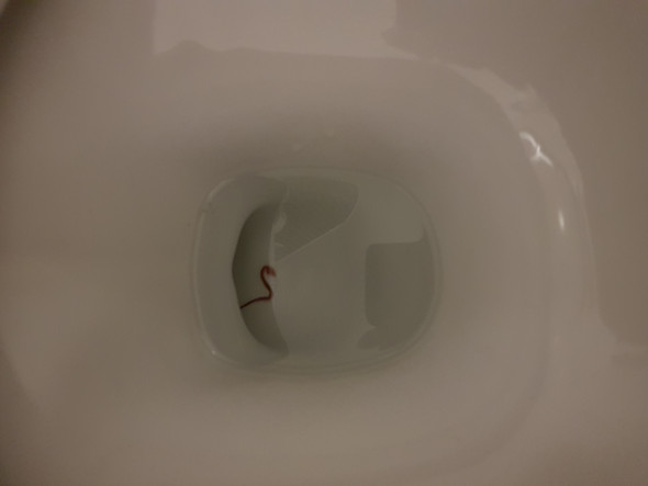 In toilette würmer schwarze Wenn in