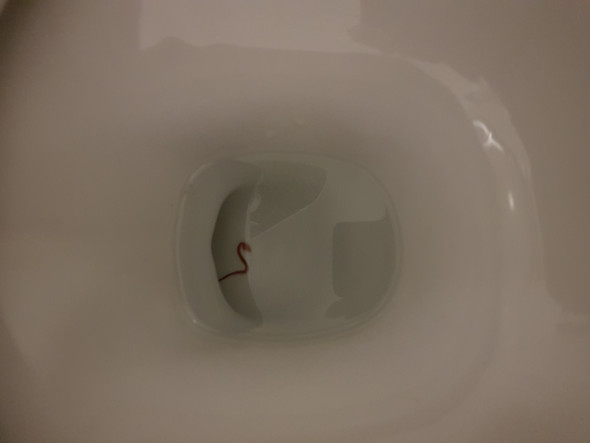Wurm Im Wc Hilfe Wurmer Wurm Im Wc Hilfe Wurmer