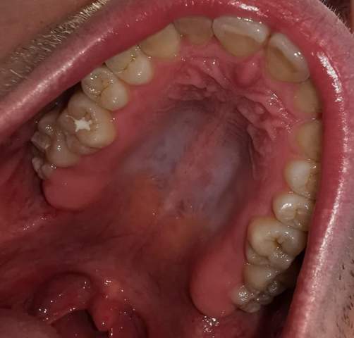 Zahnarztangst, Einschätzung meiner Zähne vor Gang zum Zahnarzt?